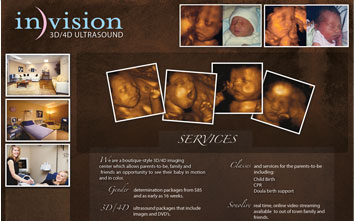 Invision Ultrasound Project